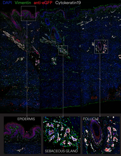 پلتفرم جامع پیش‌بینی ژن و درمان برای ارائه درمان‌های موضعی، اختصاصی پوست و ایمن برای درمان بیماری‌های نادر تک ژنی پوست و پیری